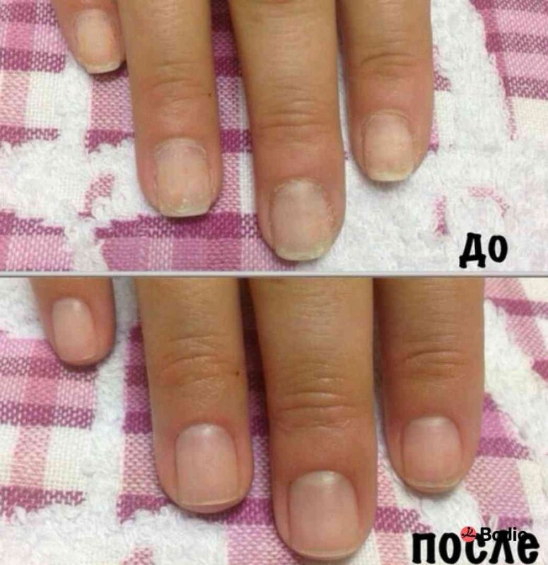 Ногти после шеллака ужасные