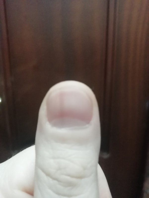 Поперечные полосы на ногах