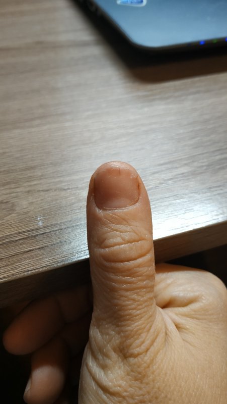 Поперечная лейконихия