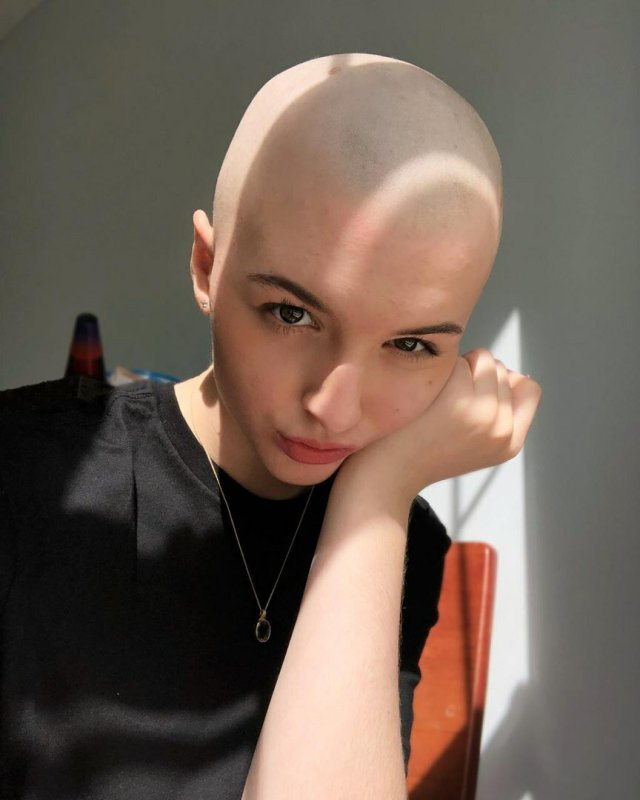 Наташа Уайтман лысая