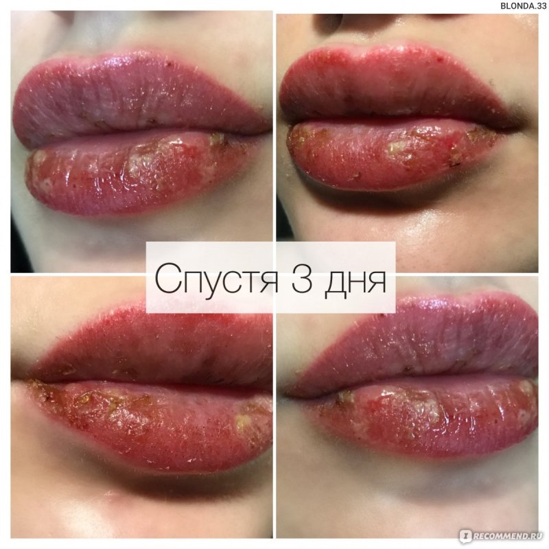Тату на губе после заживления