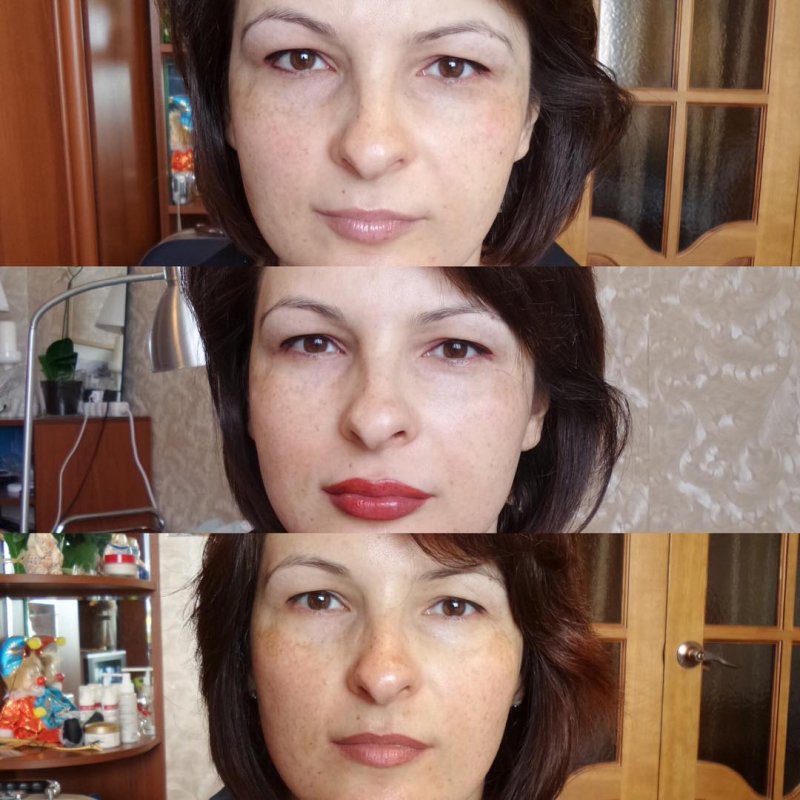 Микропигментация кожи лица