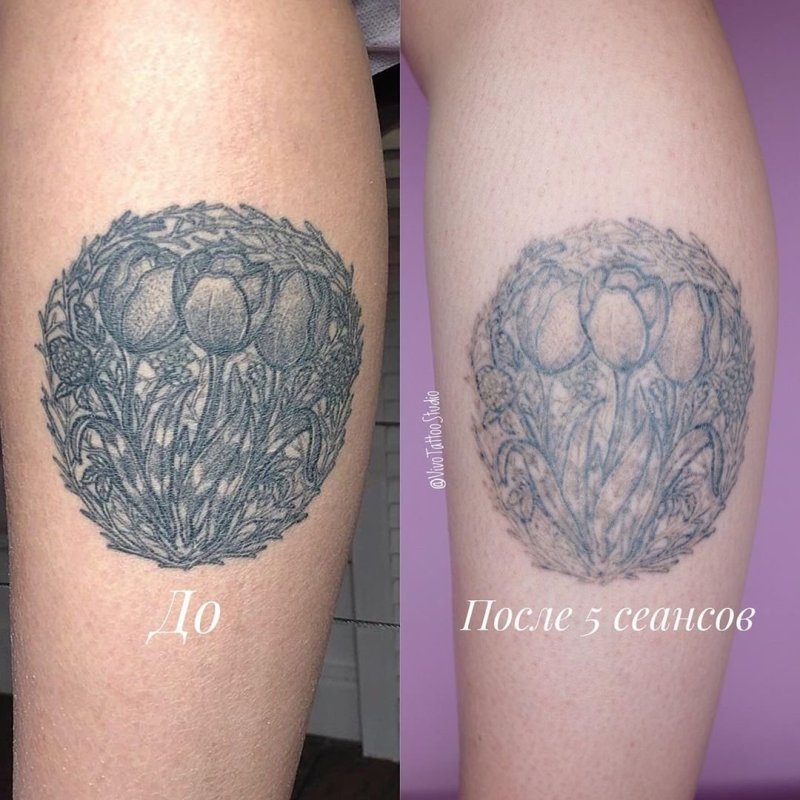 Зажившие цветные Татуировки