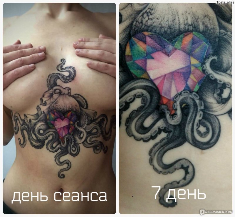 Незажившая Татуировка