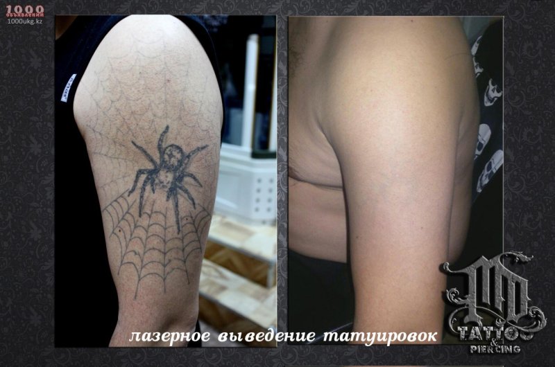 Сведенная Татуировка на руке