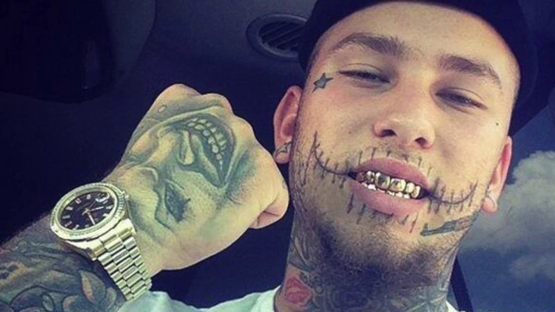Stitches Rapper