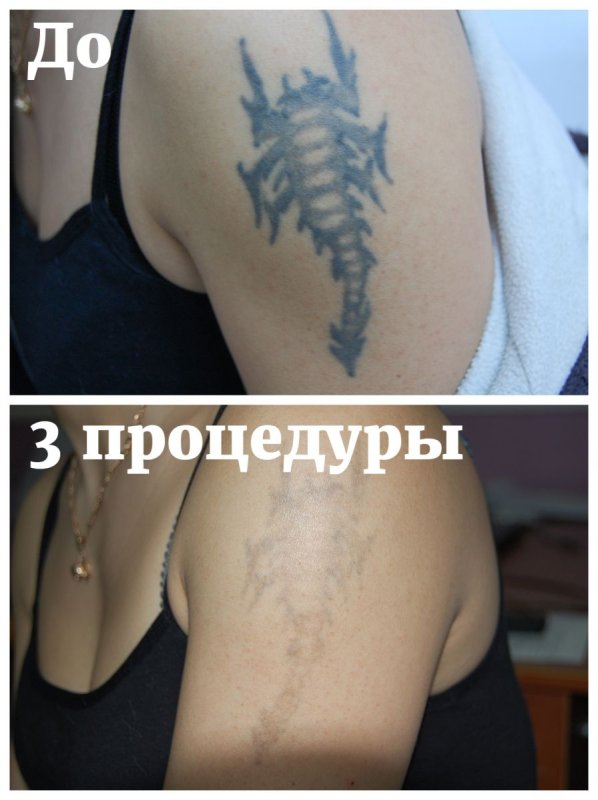 Мазь для заживления Татуировки