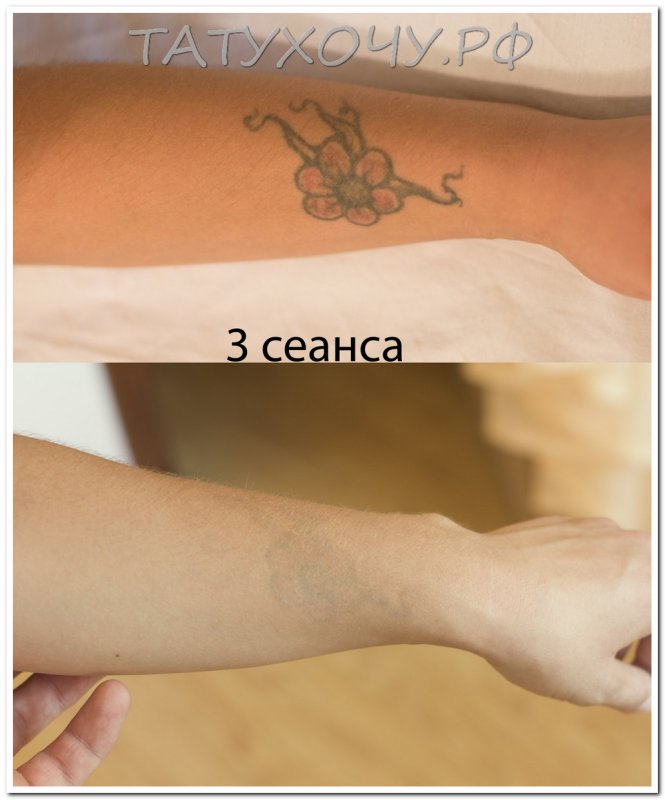 Результат сведения Татуировки