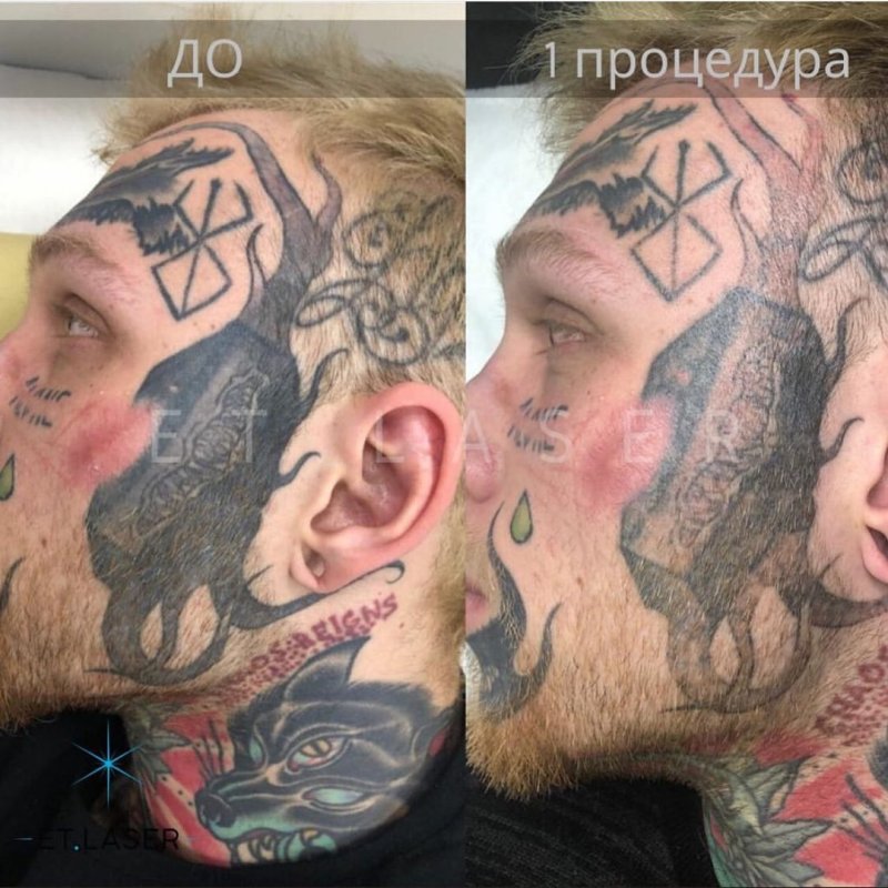 Тату через несколько лет