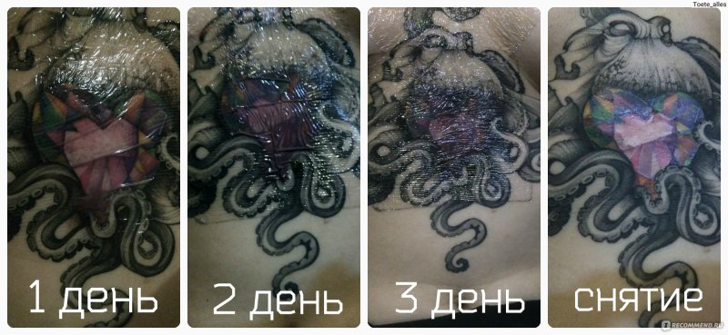 Сведение тату до и после