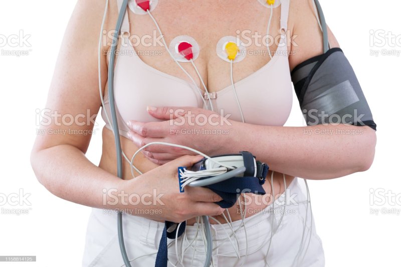 Holter ECG Monitor woman