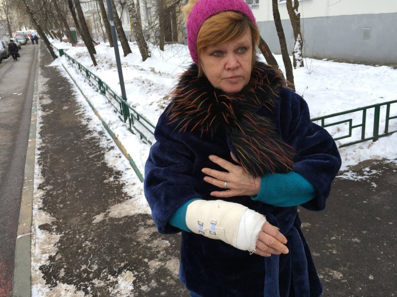 Гипсовая повязка