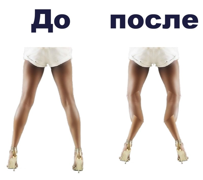 Девушка с кривыми ногами картинки
