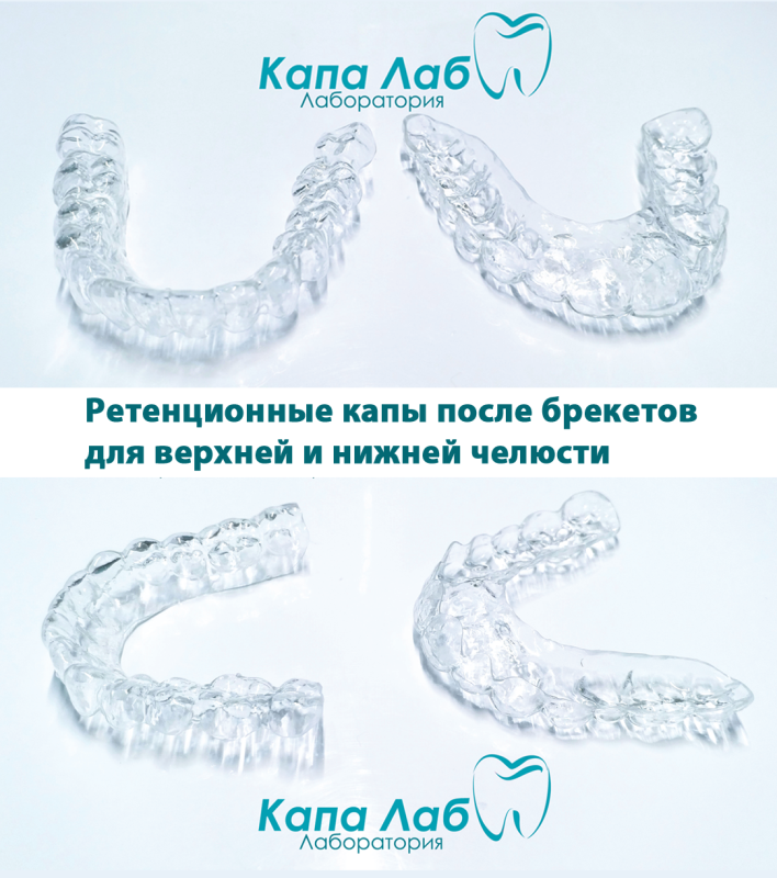 Каппы Инвизилайн
