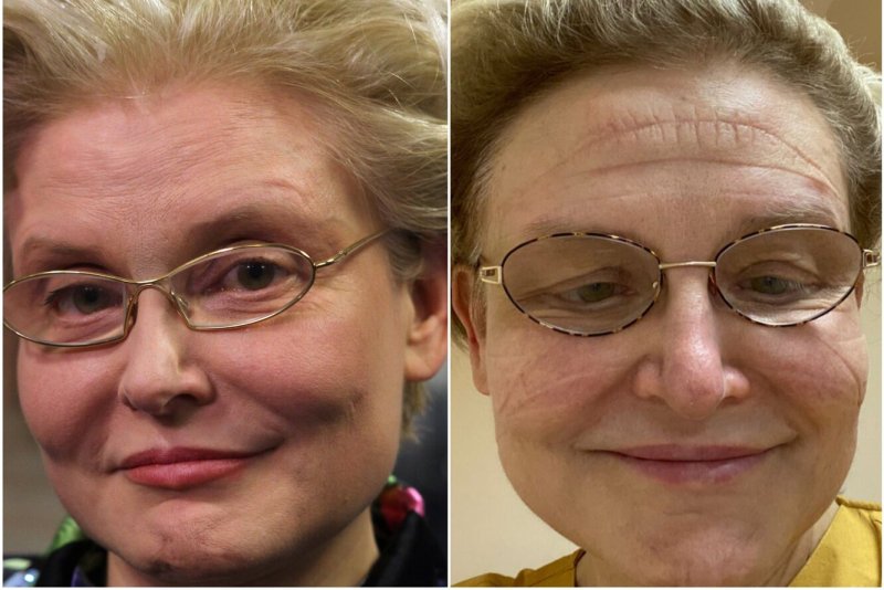 Елена Малышева жить здорово