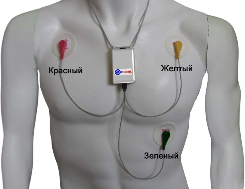 Холтеровское суточное мониторирование ЭКГ