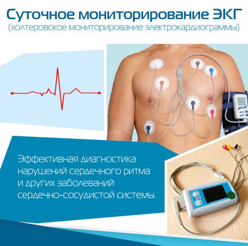 Холтеровское мониторирование кардио
