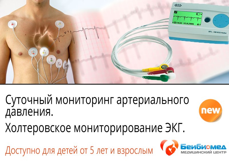 Холтер 1 отведение ЭКГ
